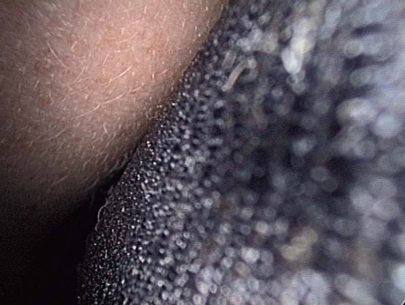 body12
